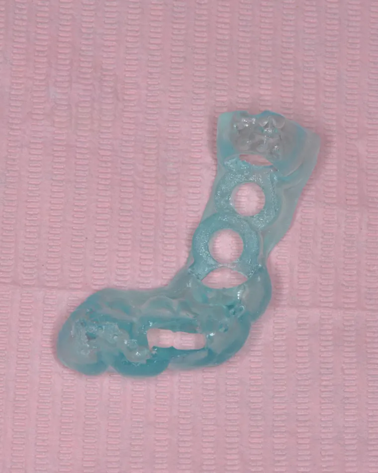 Ghid chirurgical printat 3D, din rășină verde-albăstruie, cu orificii pentru implanturi, pe un șervet roz